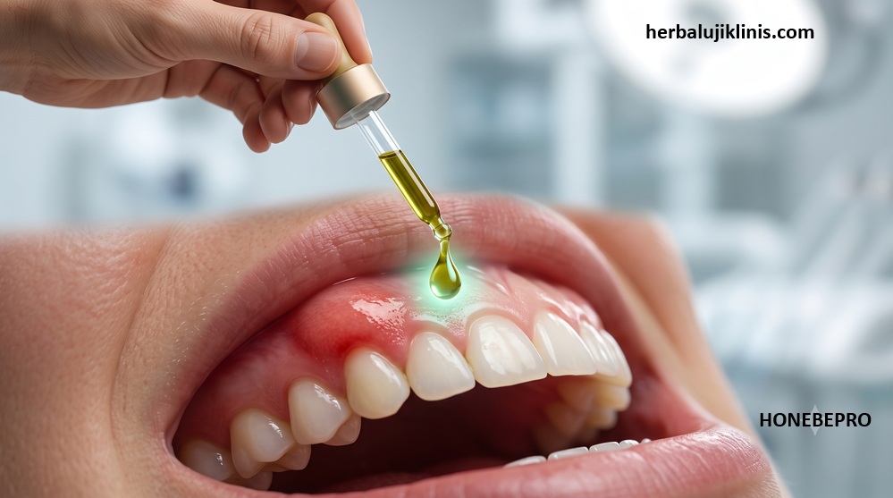 Ilustrasi Gusi Bengkak & Tetes Propolis